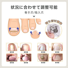 Load image into Gallery viewer, 巻き爪矯正チェーン
