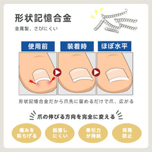 Load image into Gallery viewer, 巻き爪矯正チェーン
